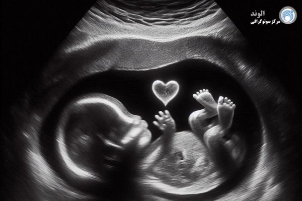  عکس سونوگرافی بارداری