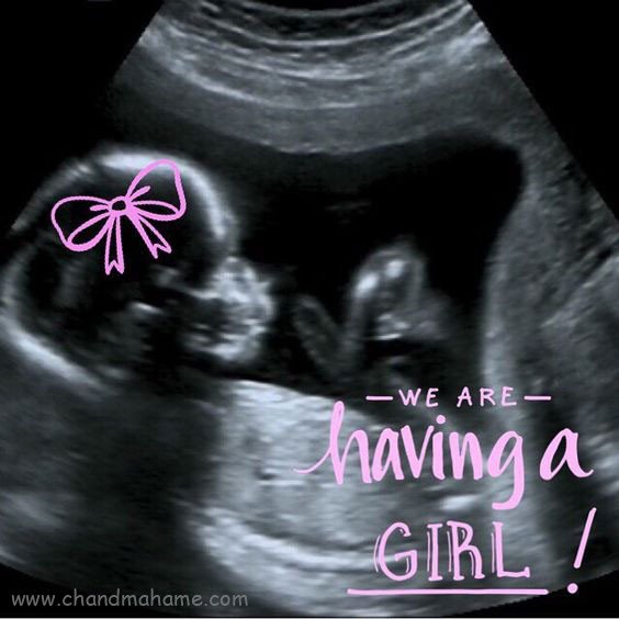  ایده عکس سونوگرافی دختر