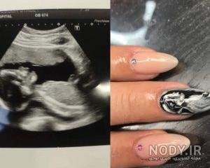  عکس سونوگرافی برای پروفایل