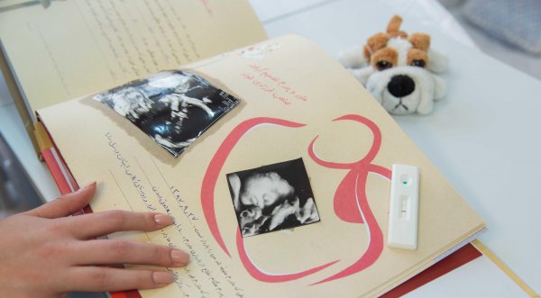  عکس سونوگرافی برای پروفایل