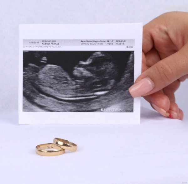  عکس سونوگرافی برای پروفایل