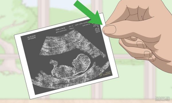  عکس سونوگرافی برای پروفایل