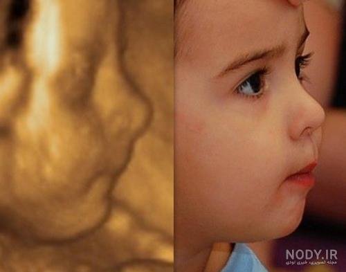 عکس سونوگرافی پسر