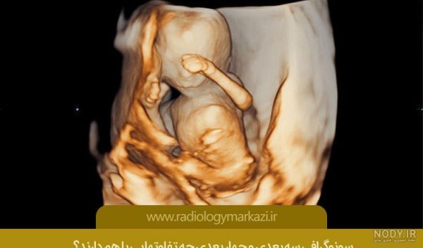  عکس سونوگرافی پسر