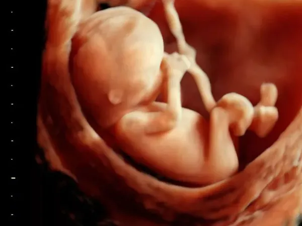  عکس سونوگرافی پسر