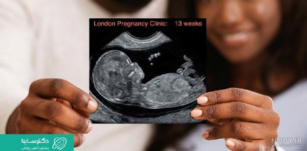  عکس سونوگرافی پسر