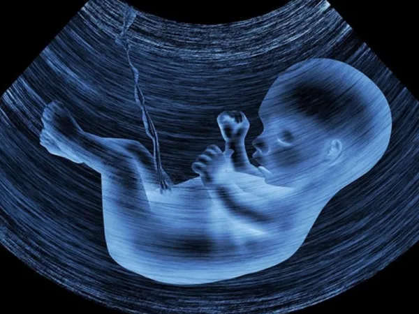  عکس سونوگرافی پسر