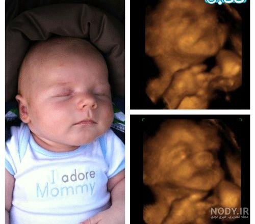  عکس سونوگرافی پسر
