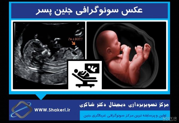  عکس سونوگرافی پسر
