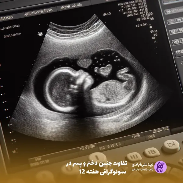  عکس سونوگرافی پسر