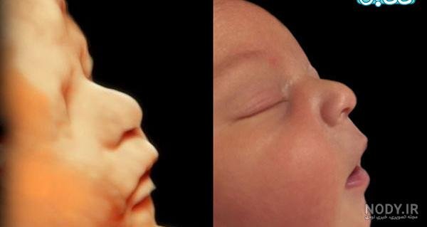  عکس سونوگرافی پسر