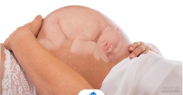  عکس سونوگرافی پسر