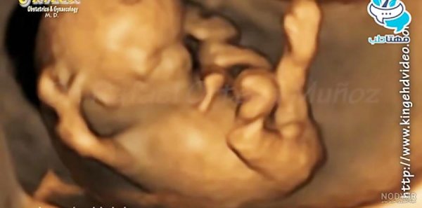  عکس سونوگرافی پسر