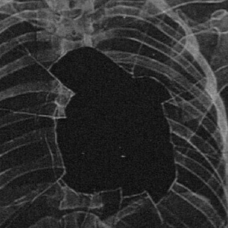  عکس های قلب شکسته