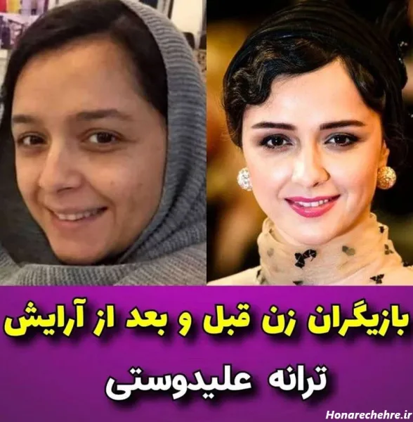  عکس دختر ایرانی ساده بدون ارایش