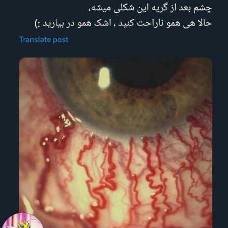  عکس چشم گریان واقعی