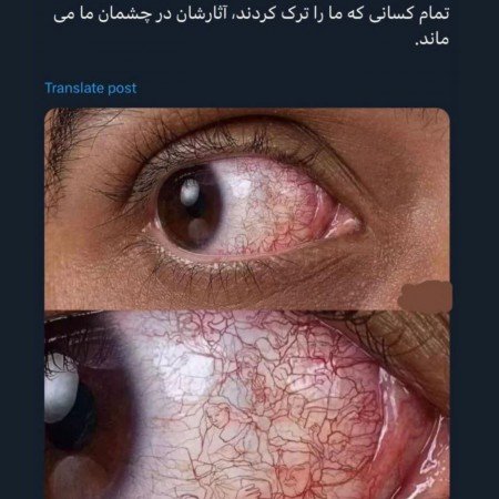  عکس چشم سبز