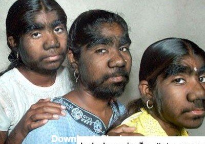  عکس دختر زشت با مقنعه