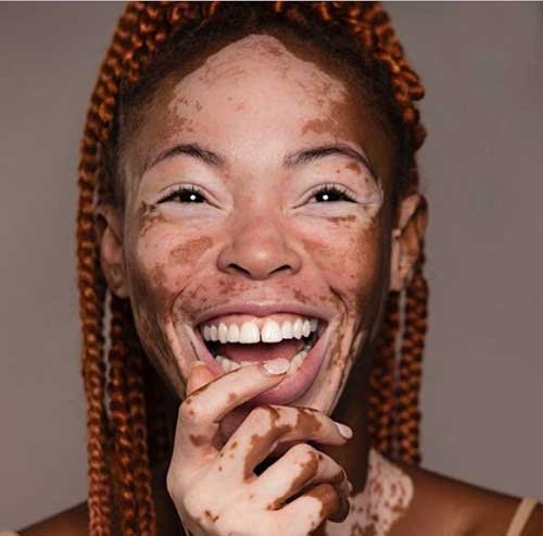  عکس دختر زشت فیک