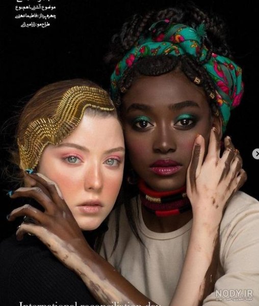  عکس دختر زشت سیاه