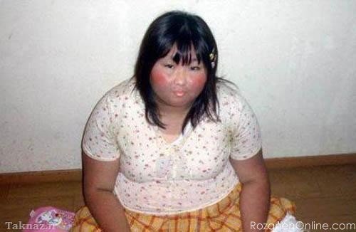  عکس دختر زشت طبیعی