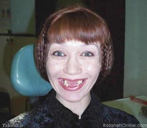  عکس دختر زشت طبیعی