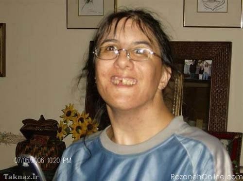  عکس دختر زشت طبیعی