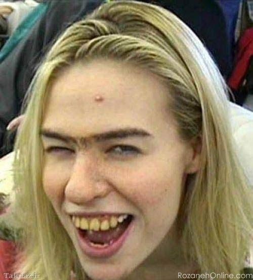  عکس دختر زشت طبیعی