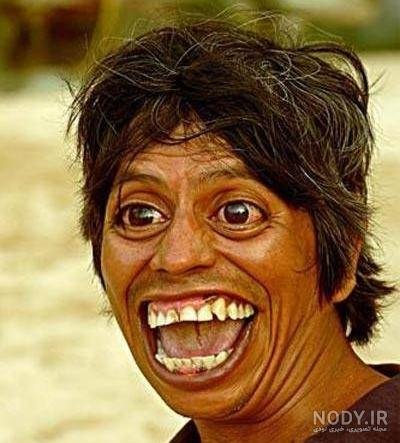 عکس مرد سیاه زشت