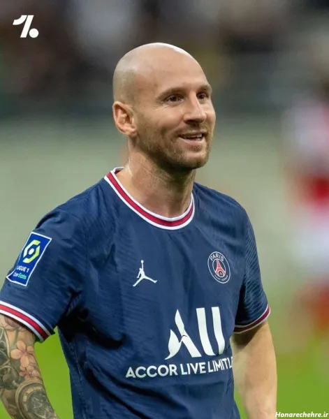  عکس مسی کچل خنده دار