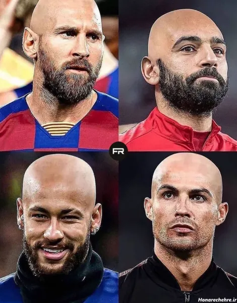  عکس مسی کچل خنده دار