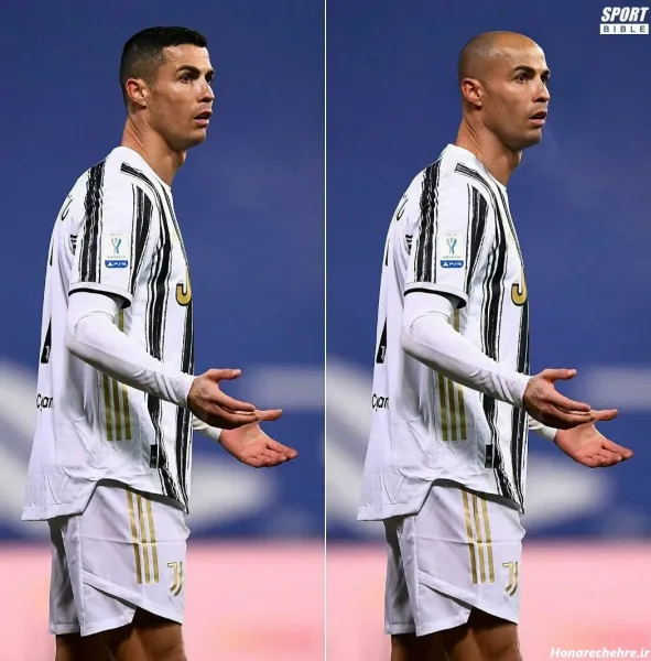  عکس مسی کچل خنده دار