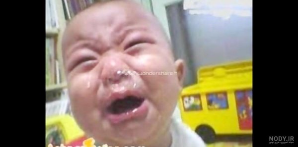  عکس بچه زشت