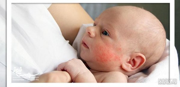  عکس بچه زشت بانمک