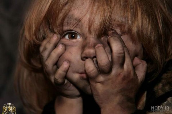  عکس بچه زشت بانمک