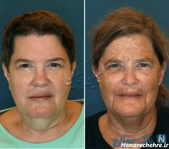  عکس خنده دار پسر