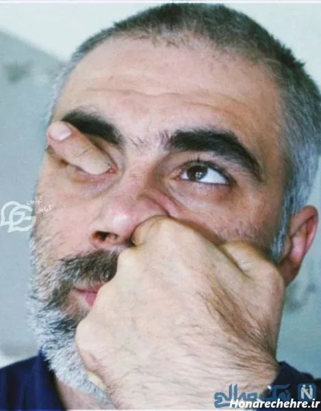  عکس خنده دار پسر