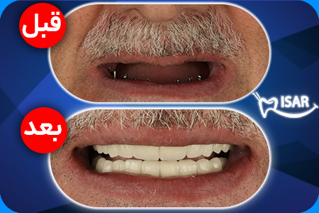  عکس هواپیما واقعی جنگی