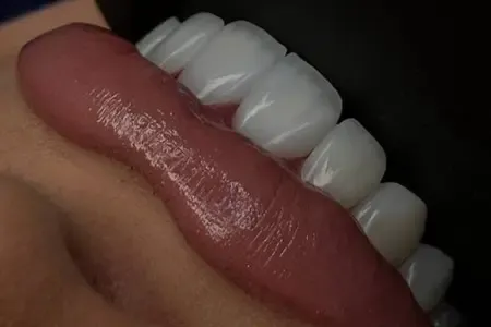  عکس اسپرت پسرانه کودک