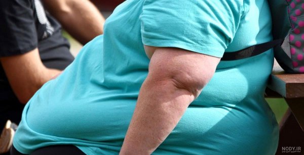  عکس دختر تپل زشت