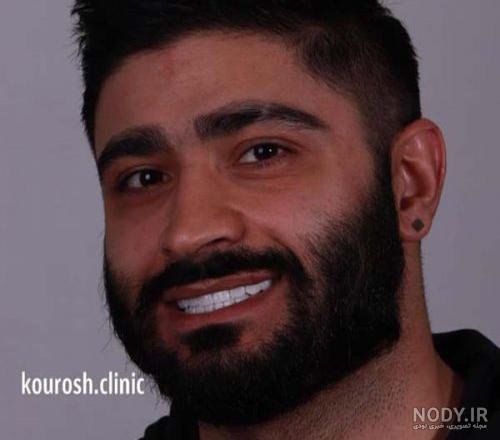  عکس لبخند مردانه