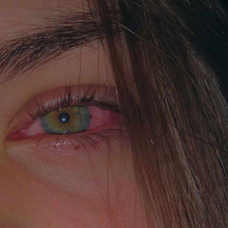  عکس گریه دختر برای پروفایل