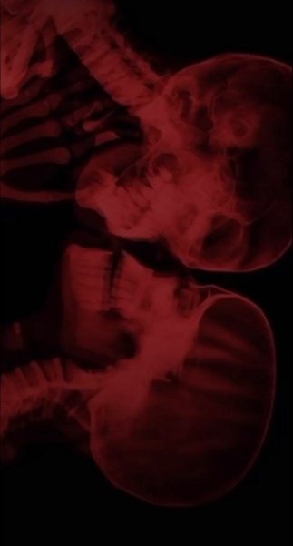  عکس قرمز شاخ