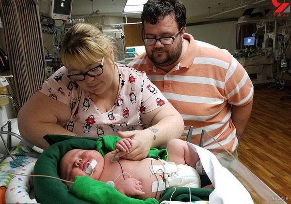  عکس نوزاد دختر در بیمارستان