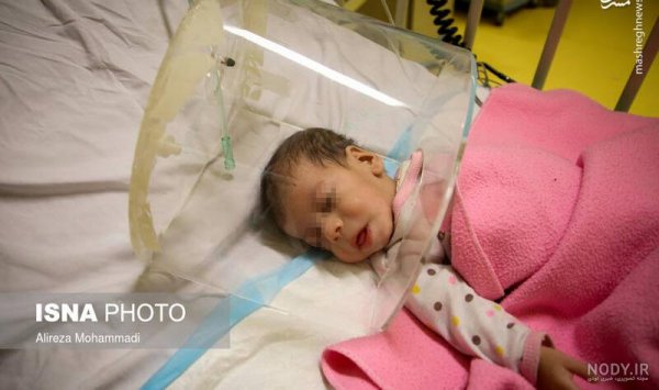  عکس نوزاد دختر در بیمارستان