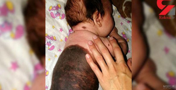  عکس نوزاد دختر در بیمارستان