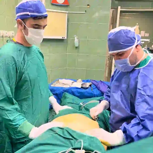  عکس بعد از عمل ابدو