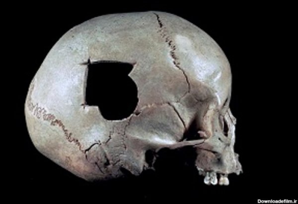 عکس اسکلت وحشی