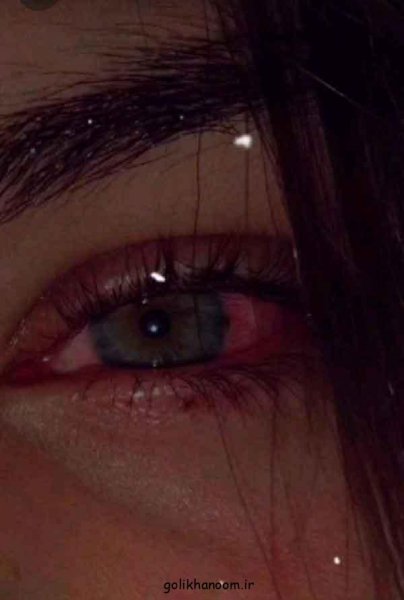  عکس غمگین بدون متن