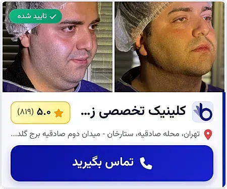  عکس نوشته روز جهانی بوسه مبارک